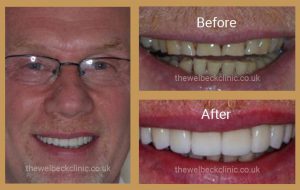 Neil Cosmetic Dentist London